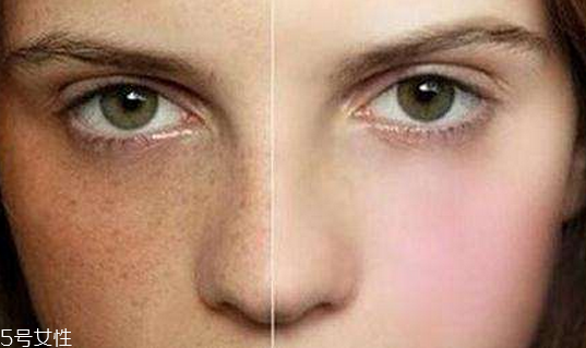 皮秒什么季節(jié)做最好 哪個(gè)季節(jié)都可以 皮秒什么季節(jié)做最好 哪個(gè)季節(jié)都可以