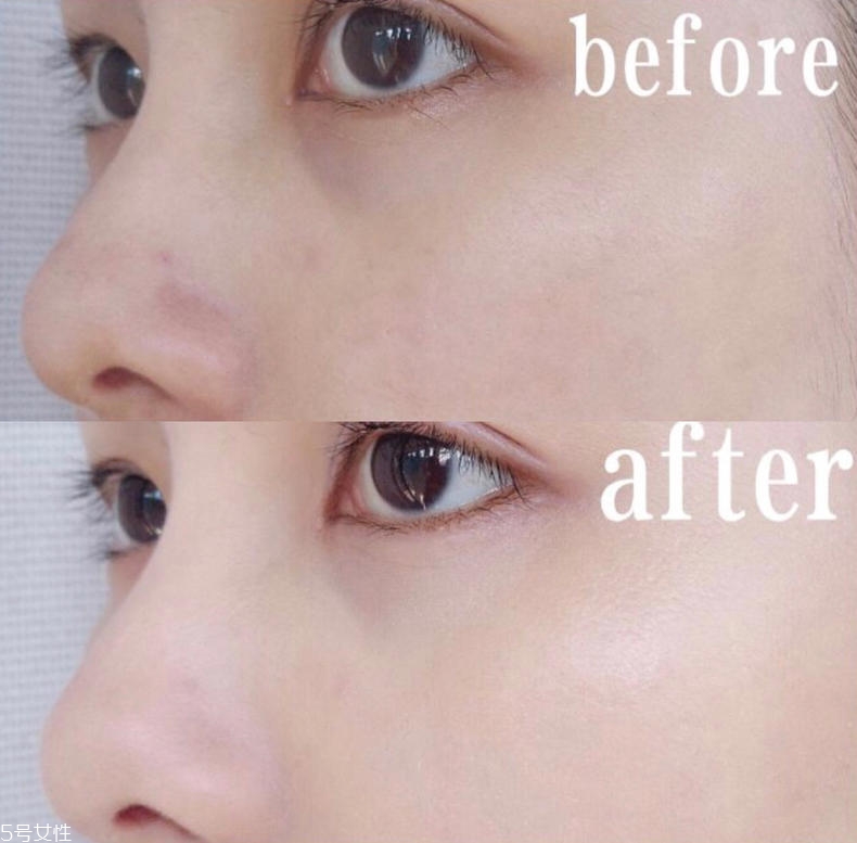 蘭蔻氣墊遮瑕效果好嗎 只能遮住紅血絲和黑眼圈 蘭蔻氣墊遮瑕效果好嗎 只能遮住紅血絲和黑眼圈