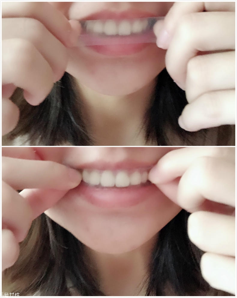 佳潔士美白牙貼有害嗎 不會傷害到牙釉質(zhì) 佳潔士美白牙貼有害嗎 不會傷害到牙釉質(zhì)