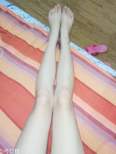 腿毛是遺傳的嗎 有這個(gè)可能