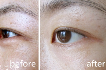 眼霜什么成分能去皺 預防皺紋從現(xiàn)在開始 眼霜什么成分能去皺 預防皺紋從現(xiàn)在開始