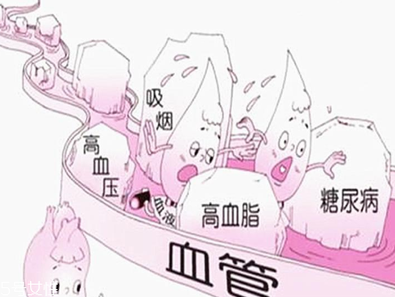 怎樣讓血管更年輕 只需要做到三步就行了 怎樣讓血管更年輕 只需要做到三步就行了