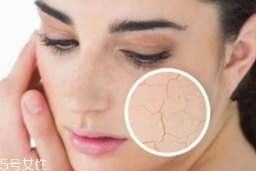 夏天吹空調皮膚會干嗎 做到這幾點就好