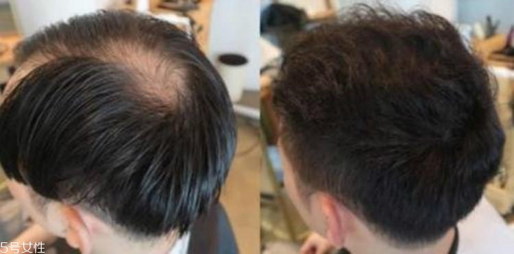 男生燙發(fā)有幾種燙法 3種基礎燙發(fā)要了解