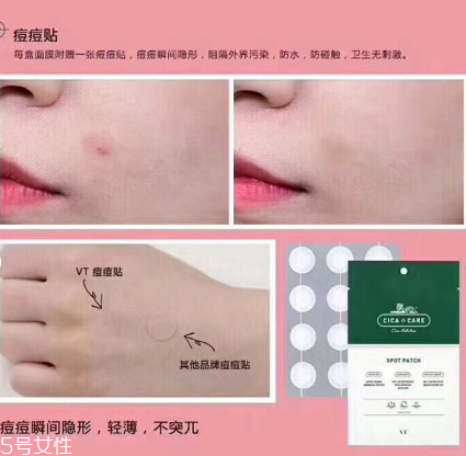 vt痘痘貼怎么樣 張韶涵推薦 vt痘痘貼怎么樣 張韶涵推薦