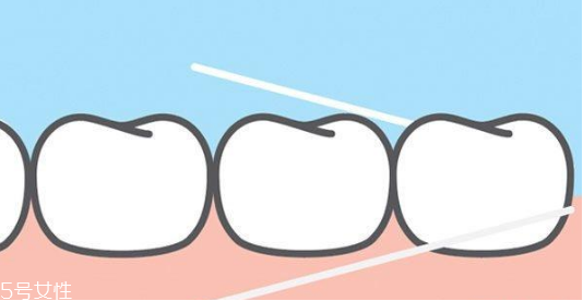 歐樂(lè)b牙線使用方法 3個(gè)步驟不傷牙齦 歐樂(lè)b牙線使用方法 3個(gè)步驟不傷牙齦