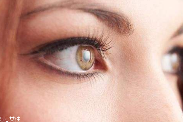 ?；瘖y戴隱形眼鏡如何預(yù)防眼結(jié)石