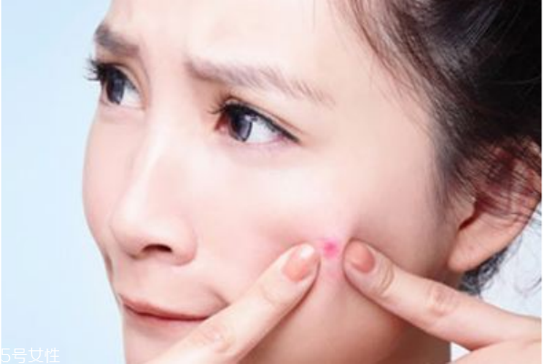 悶痘怎么才能發(fā)出來 長(zhǎng)悶痘這樣快速消除