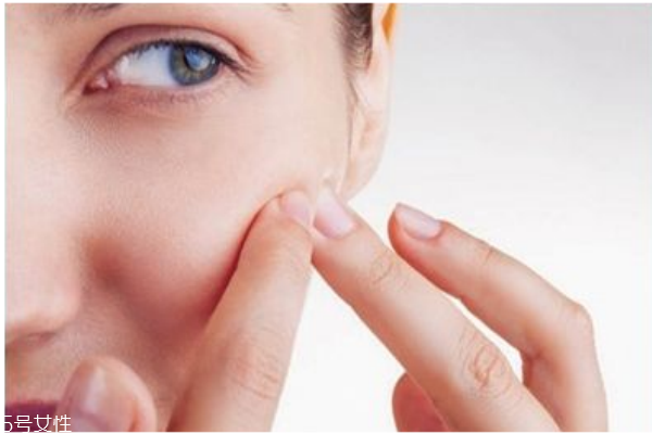 悶痘怎么才能發(fā)出來 長(zhǎng)悶痘這樣快速消除