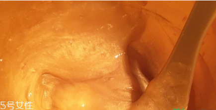 香蒲麗黃金面膜可以分兩次用嗎 香蒲麗黃金面膜功效 香蒲麗黃金面膜可以分兩次用嗎 香蒲麗黃金面膜功效