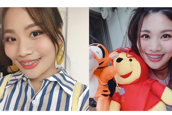 國(guó)字臉怎么瘦臉 4方法和方形臉說(shuō)掰掰 國(guó)字臉怎么瘦臉 4方法和方形臉說(shuō)掰掰