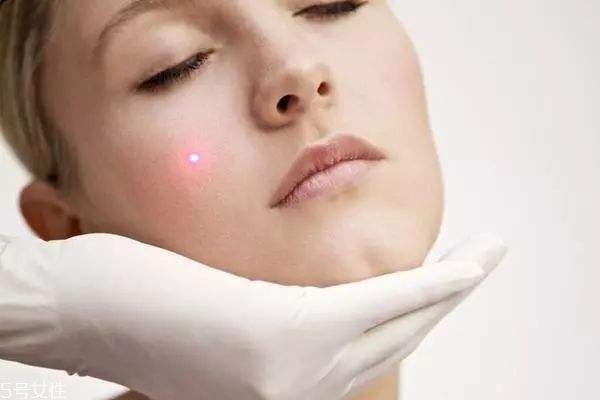 什么痘痘不能擠 這種痘擠破一定會留疤 什么痘痘不能擠 這種痘擠破一定會留疤