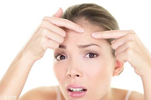 擠痘痘工具用什么好 用指甲擠會留疤 擠痘痘工具用什么好 用指甲擠會留疤