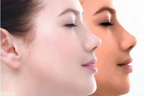 臉部汗毛這么多 你還能忍受嗎 臉部汗毛這么多 你還能忍受嗎