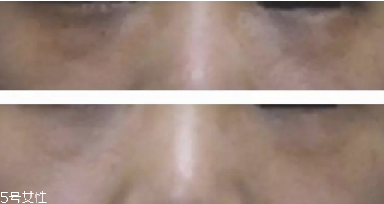 黑眼圈怎么遮瑕小竅門 底子不夠遮瑕來(lái)救