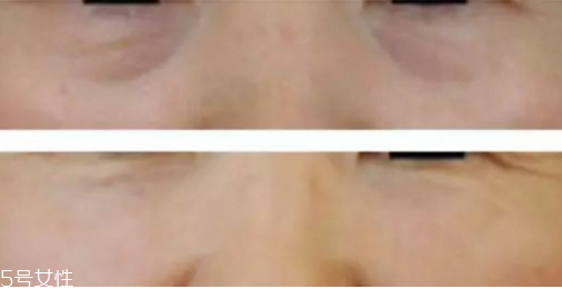 黑眼圈怎么遮瑕小竅門 底子不夠遮瑕來(lái)救