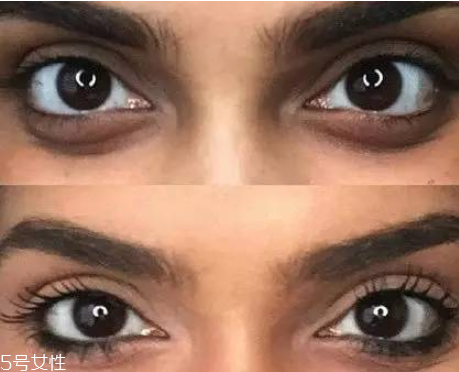 黑眼圈怎么遮瑕小竅門 底子不夠遮瑕來(lái)救