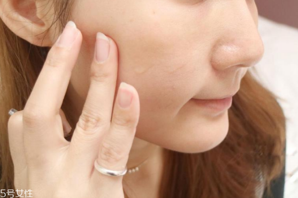 安瓶可以去細紋嗎 修復(fù)和抗老安瓶能去細紋