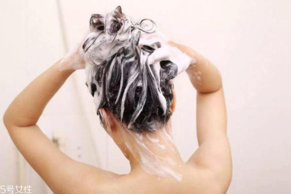 頭皮屑反復(fù)發(fā)作怎么辦 不能盲目去油 頭皮屑反復(fù)發(fā)作怎么辦 不能盲目去油