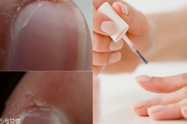 護(hù)甲油和指緣油有什么區(qū)別 護(hù)甲油能增加指甲厚度 護(hù)甲油和指緣油有什么區(qū)別 護(hù)甲油能增加指甲厚度