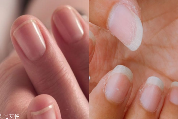 護(hù)甲油和指緣油有什么區(qū)別 護(hù)甲油能增加指甲厚度 護(hù)甲油和指緣油有什么區(qū)別 護(hù)甲油能增加指甲厚度