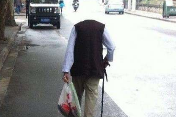 痛風(fēng)盛行率上升 如何正確預(yù)防 痛風(fēng)盛行率上升 如何正確預(yù)防