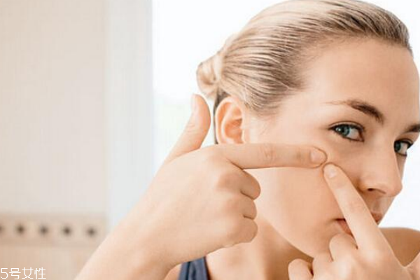 紅腫痘痘怎么遮瑕 想完美遮瑕就靠這2招 紅腫痘痘怎么遮瑕 想完美遮瑕就靠這2招