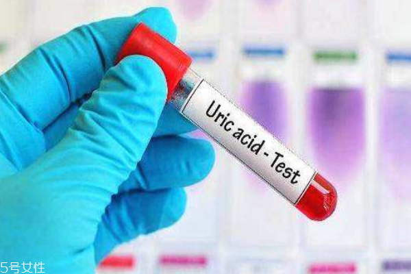 體檢尿酸偏高有痛風(fēng)危險(xiǎn)如何應(yīng)對(duì) 體檢尿酸偏高有痛風(fēng)危險(xiǎn)如何應(yīng)對(duì)