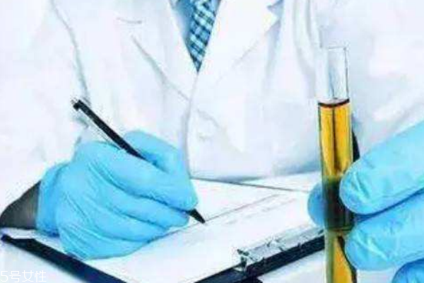 體檢尿酸偏高有痛風(fēng)危險(xiǎn)如何應(yīng)對(duì) 體檢尿酸偏高有痛風(fēng)危險(xiǎn)如何應(yīng)對(duì)