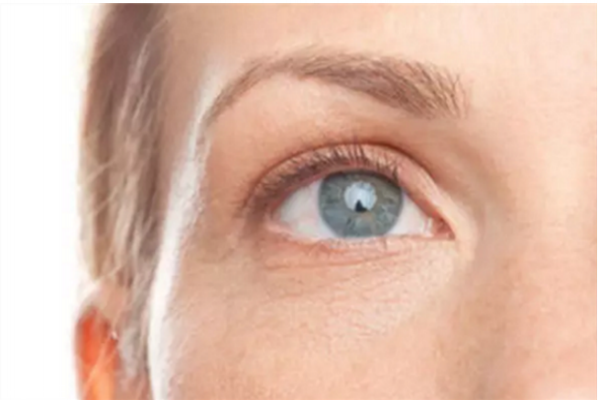 魚尾紋激光有副作用嗎 激光去除魚尾紋風險 魚尾紋激光有副作用嗎 激光去除魚尾紋風險