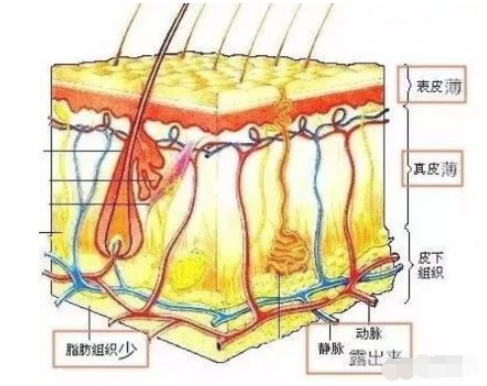 黑眼圈嚴重怎么去除 跟熊貓眼說byebye