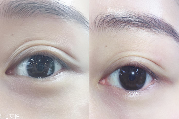 安視優(yōu)日拋怎么樣 集美貌與舒適并存 安視優(yōu)日拋怎么樣 集美貌與舒適并存