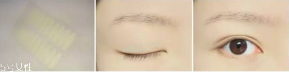 隱形雙眼皮貼怎么貼 雙眼皮貼貼法技巧教程 隱形雙眼皮貼怎么貼 雙眼皮貼貼法技巧教程