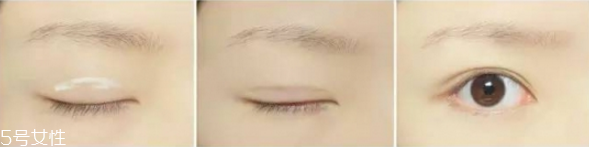 隱形雙眼皮貼怎么貼 雙眼皮貼貼法技巧教程 隱形雙眼皮貼怎么貼 雙眼皮貼貼法技巧教程