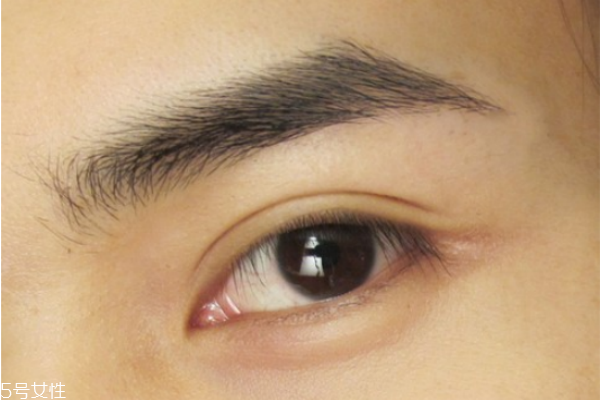 雙眼皮貼老是翻出來(lái)怎么辦 貼出自然持久雙眼皮 雙眼皮貼老是翻出來(lái)怎么辦 貼出自然持久雙眼皮