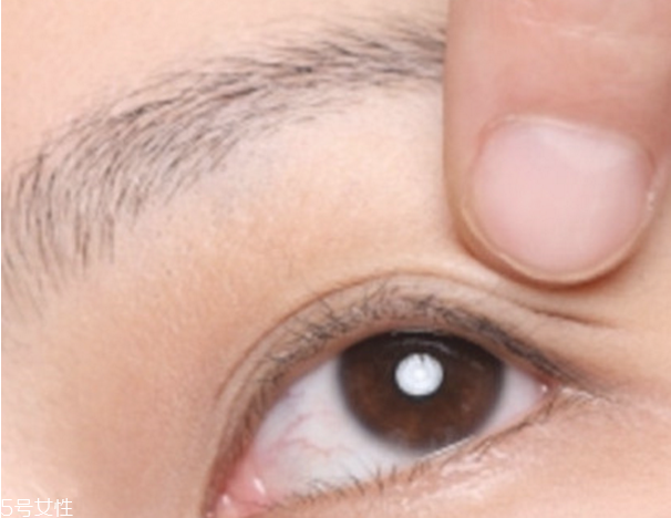 雙眼皮貼老是翻出來(lái)怎么辦 貼出自然持久雙眼皮 雙眼皮貼老是翻出來(lái)怎么辦 貼出自然持久雙眼皮