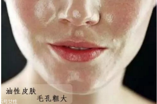 怎么判斷自己什么膚質 油皮應該如何護膚