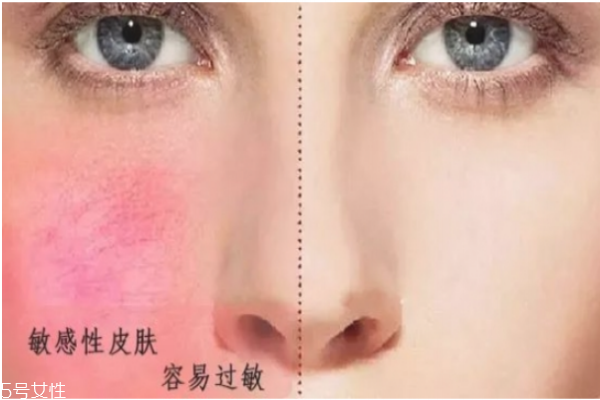怎么判斷自己什么膚質 油皮應該如何護膚