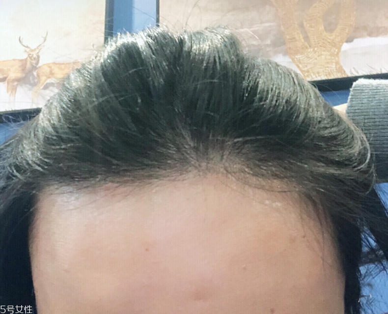 霸王育發(fā)液能生發(fā)嗎 霸王育發(fā)液用了頭癢怎么回事 霸王育發(fā)液能生發(fā)嗎 霸王育發(fā)液用了頭癢怎么回事