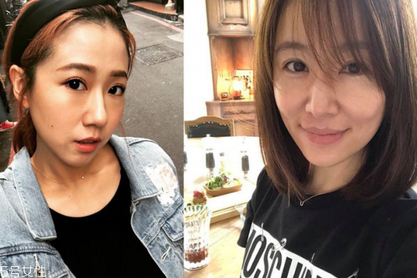 產(chǎn)后落發(fā)嚴(yán)重怎么辦 產(chǎn)后落發(fā)吃什么好 產(chǎn)后落發(fā)嚴(yán)重怎么辦 產(chǎn)后落發(fā)吃什么好