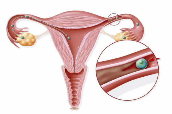 女性卵巢保養(yǎng)有效快速的方法有七點(diǎn) 女性卵巢保養(yǎng)有效快速的方法有七點(diǎn)
