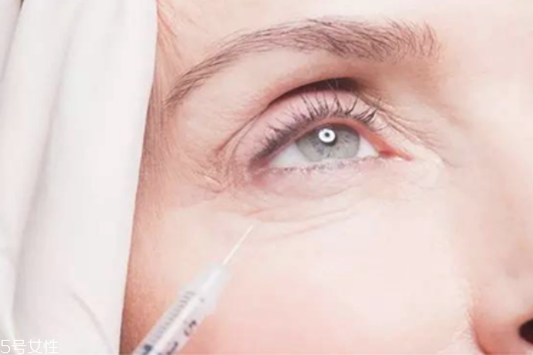 去魚尾紋的最好土方法 魚尾紋除皺方法 去魚尾紋的最好土方法 魚尾紋除皺方法