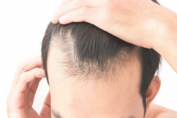 有硅油的洗發(fā)水對人體有害 到底怎么選擇洗發(fā)水 有硅油的洗發(fā)水對人體有害 到底怎么選擇洗發(fā)水