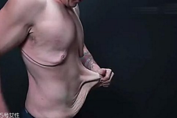 皮膚松弛，你應(yīng)該為肌膚補(bǔ)充營養(yǎng)