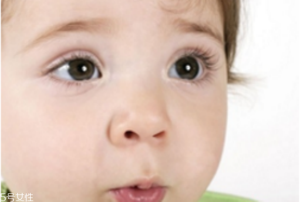 寶寶斗雞眼怎么辦 斗雞眼怎么治療 寶寶斗雞眼怎么辦 斗雞眼怎么治療