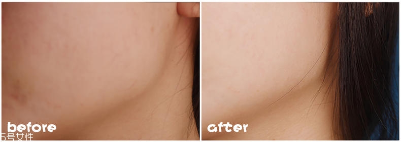 olay光感小白瓶孕婦能用嗎 olay光感小白瓶成分解析 olay光感小白瓶孕婦能用嗎 olay光感小白瓶成分解析