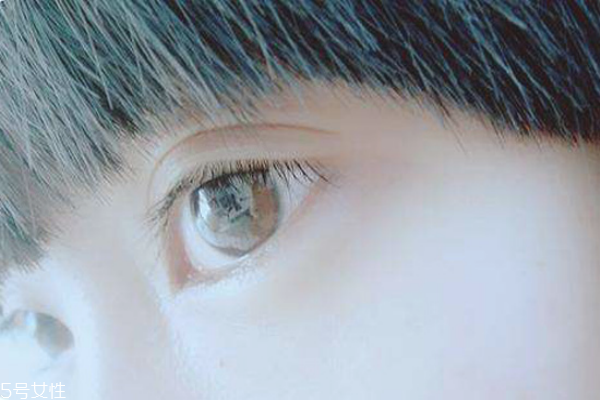 麥粒腫可以自己挑破嗎 麥粒腫手術(shù)多久恢復(fù) 麥粒腫可以自己挑破嗎 麥粒腫手術(shù)多久恢復(fù)