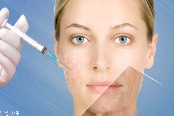 除皺的方法很多，你適合哪一種