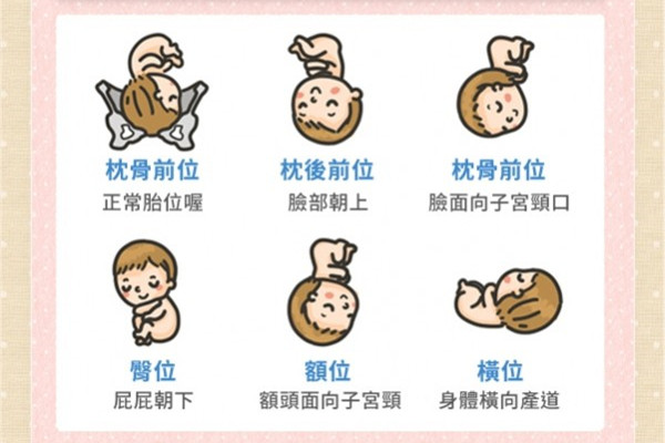 什么是胎位不正圖片 胎位不正教你矯正 什么是胎位不正圖片 胎位不正教你矯正