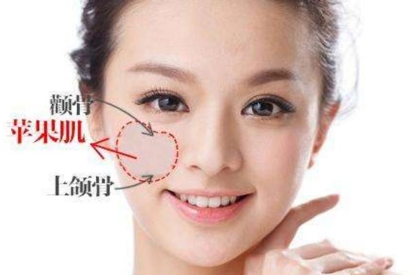 蘋果肌塌陷怎么辦 蘋果肌在哪個(gè)位置